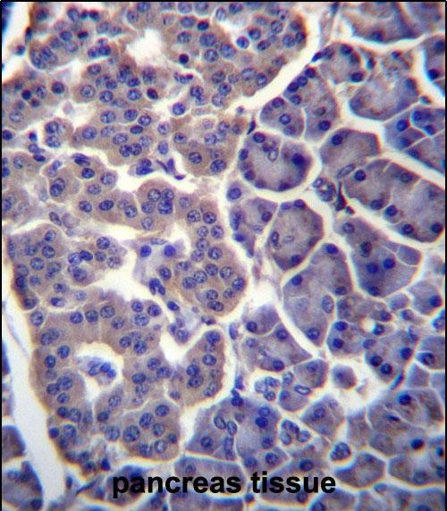 TM9SF2 Antibody in Immunohistochemistry (Paraffin) (IHC (P))