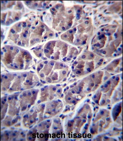 Calpain 8 Antibody in Immunohistochemistry (Paraffin) (IHC (P))
