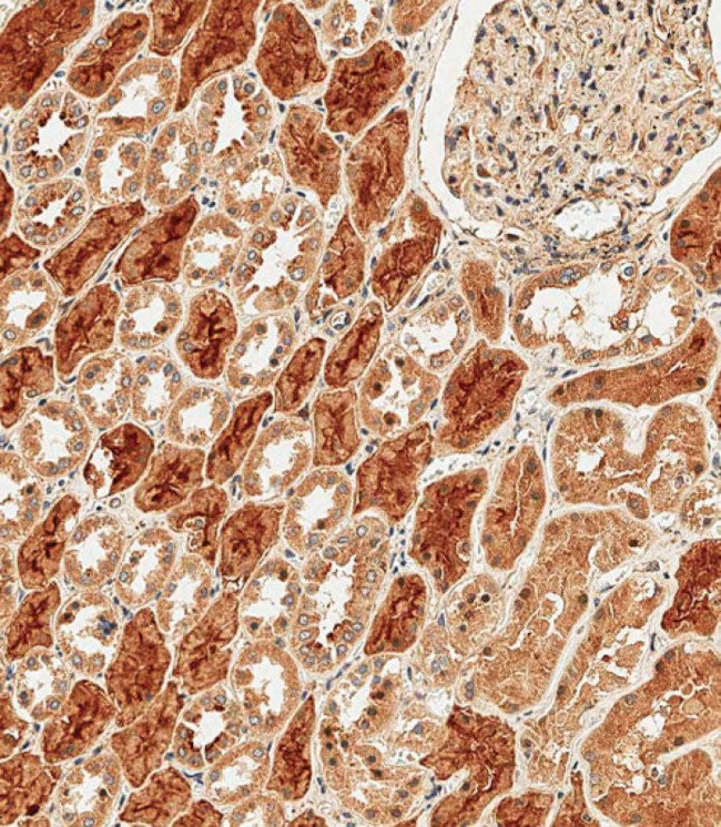 PCDH9 Antibody in Immunohistochemistry (Paraffin) (IHC (P))