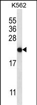 CHAC2 Antibody in Western Blot (WB)