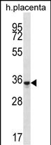 OR6K6 Antibody in Western Blot (WB)