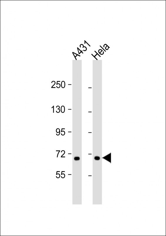 CCDC120 Antibody in Western Blot (WB)