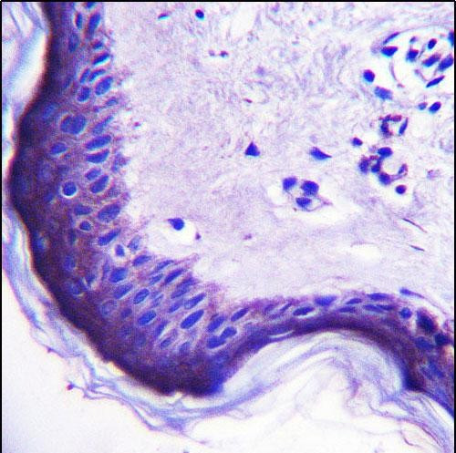 ERV3 Antibody in Immunohistochemistry (Paraffin) (IHC (P))