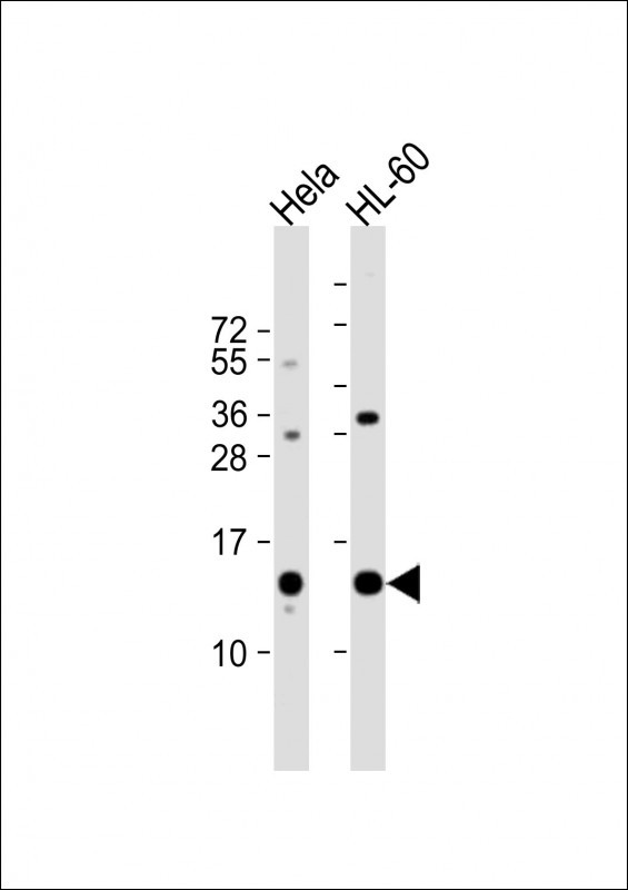 PHF5A Antibody in Western Blot (WB)