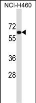 UGT2B11 Antibody in Western Blot (WB)
