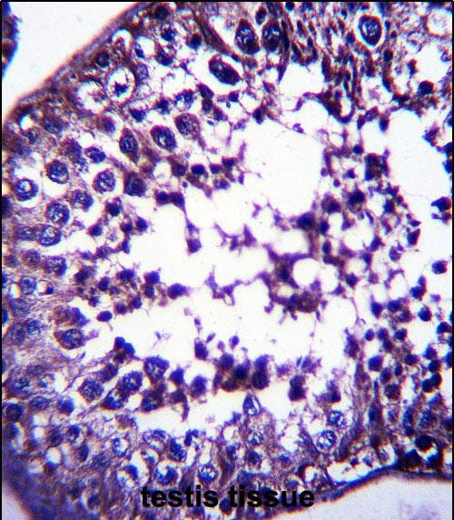 TSPYL5 Antibody in Immunohistochemistry (Paraffin) (IHC (P))