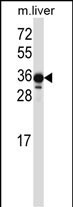 LIMS2 Antibody in Western Blot (WB)