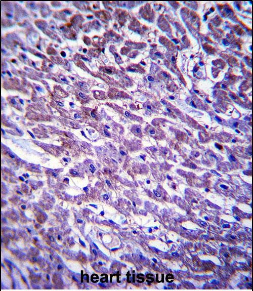 XIRP1 Antibody in Immunohistochemistry (Paraffin) (IHC (P))