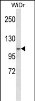 ZNF836 Antibody in Western Blot (WB)