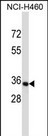 OR14C36 Antibody in Western Blot (WB)