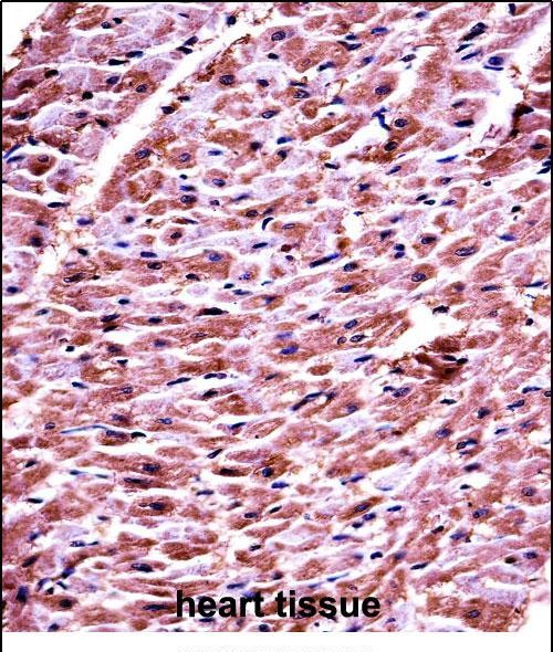 DHRS7C Antibody in Immunohistochemistry (Paraffin) (IHC (P))