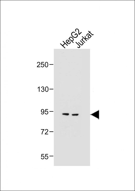 MGAT5 Antibody in Western Blot (WB)