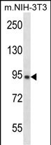 GRAMD1A Antibody in Western Blot (WB)