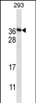 FAM122A Antibody in Western Blot (WB)