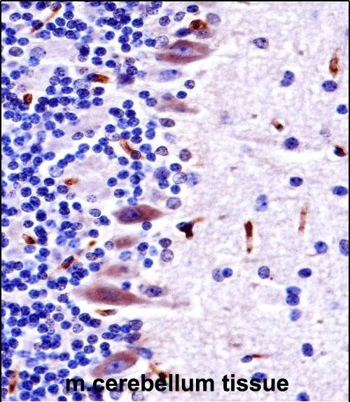 MLK4 Antibody in Immunohistochemistry (Paraffin) (IHC (P))