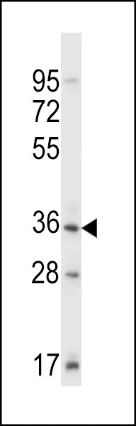 Sgk110 Antibody in Western Blot (WB)