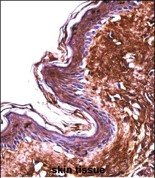 PPT2 Antibody in Immunohistochemistry (Paraffin) (IHC (P))