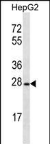 OR8B12 Antibody in Western Blot (WB)