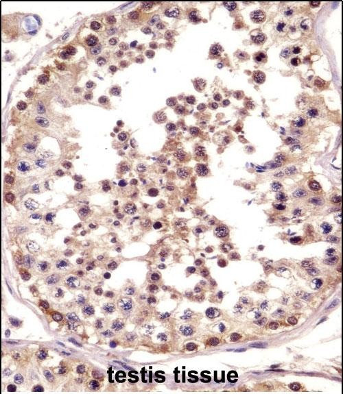 TSPY1 Antibody in Immunohistochemistry (Paraffin) (IHC (P))