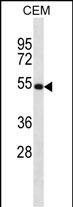NTN3 Antibody in Western Blot (WB)