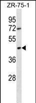 OR2T6 Antibody in Western Blot (WB)