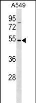 TM6SF1 Antibody in Western Blot (WB)