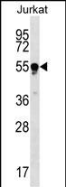TUBB4Q Antibody in Western Blot (WB)