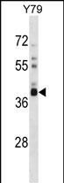 OR52L1 Antibody in Western Blot (WB)