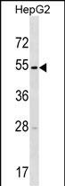 TMPRSS11E Antibody in Western Blot (WB)