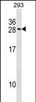 MARCKSL1 Antibody in Western Blot (WB)