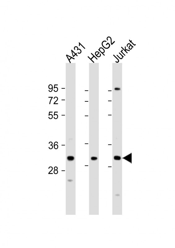 LY6G6F Antibody in Western Blot (WB)