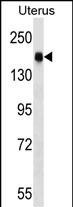 CGNL1 Antibody in Western Blot (WB)