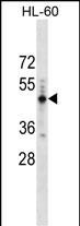 PRAMEF14 Antibody in Western Blot (WB)