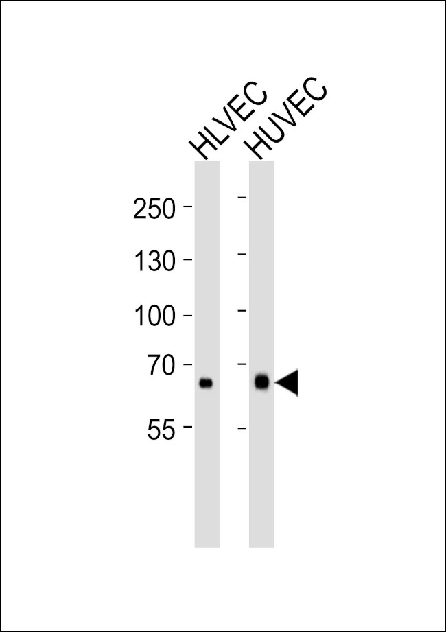 MMRN1 Antibody in Western Blot (WB)