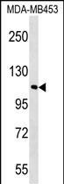 FAM65B Antibody in Western Blot (WB)