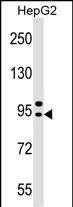 AP4B1 Antibody in Western Blot (WB)