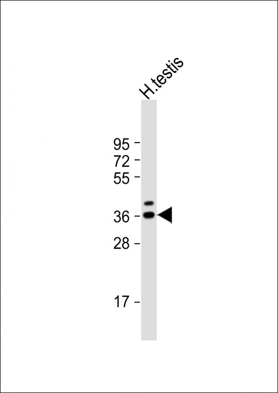 TSPY3 Antibody in Western Blot (WB)