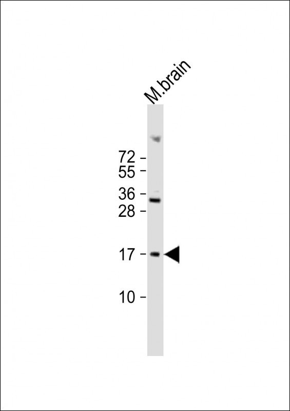 FUNDC1 Antibody in Western Blot (WB)