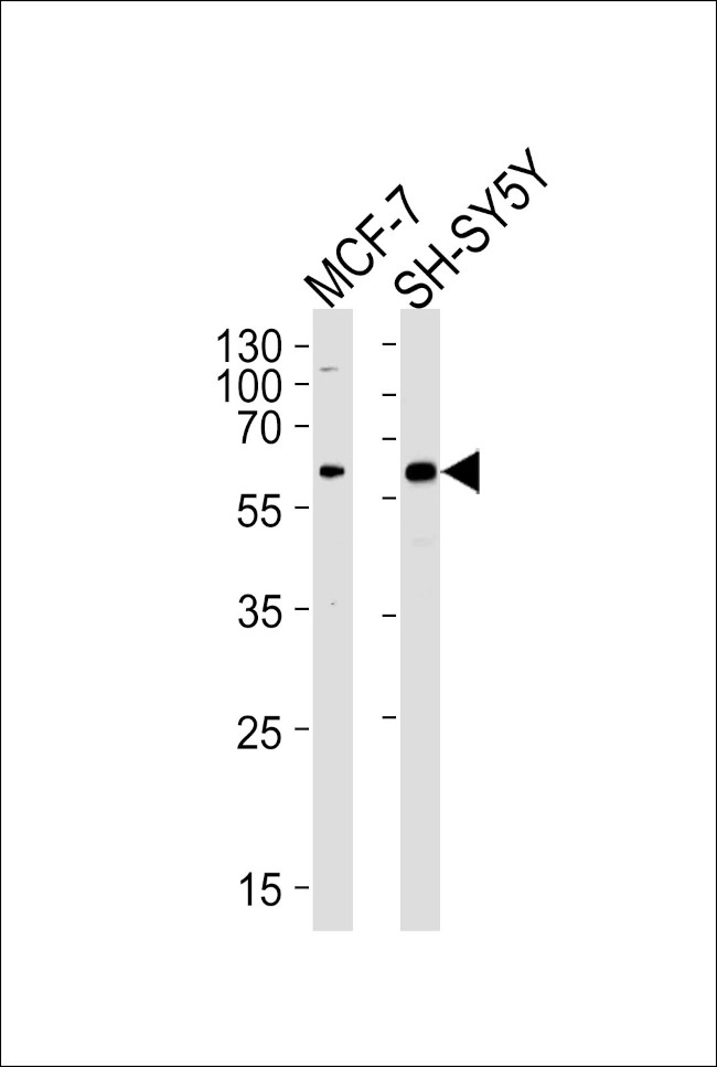 ZBTB22 Antibody in Western Blot (WB)