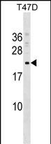 COMMD9 Antibody in Western Blot (WB)