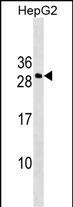 DDIT4L Antibody in Western Blot (WB)