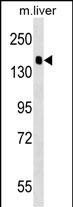 PPFIA2 Antibody in Western Blot (WB)