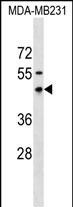 RNFT1 Antibody in Western Blot (WB)