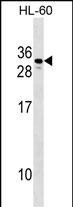 hCG beta-1 Antibody in Western Blot (WB)