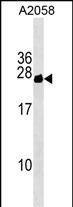 CYorf15B Antibody in Western Blot (WB)