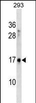 SYS1 Antibody in Western Blot (WB)