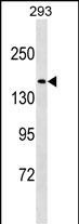 NUP188 Antibody in Western Blot (WB)