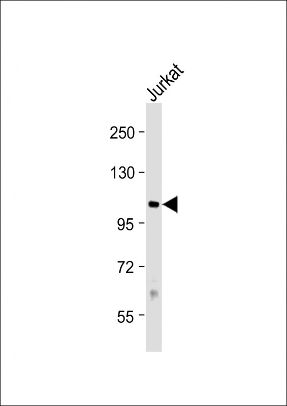PRMT9 Antibody in Western Blot (WB)