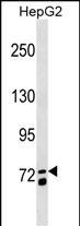 MS4A14 Antibody in Western Blot (WB)