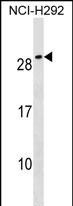 CFC1B Antibody in Western Blot (WB)